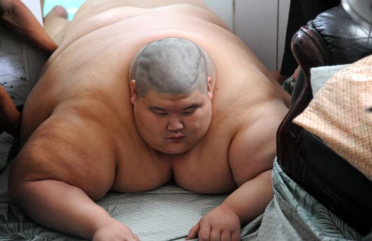 A Fire Brigade Bathe Obese Man In China